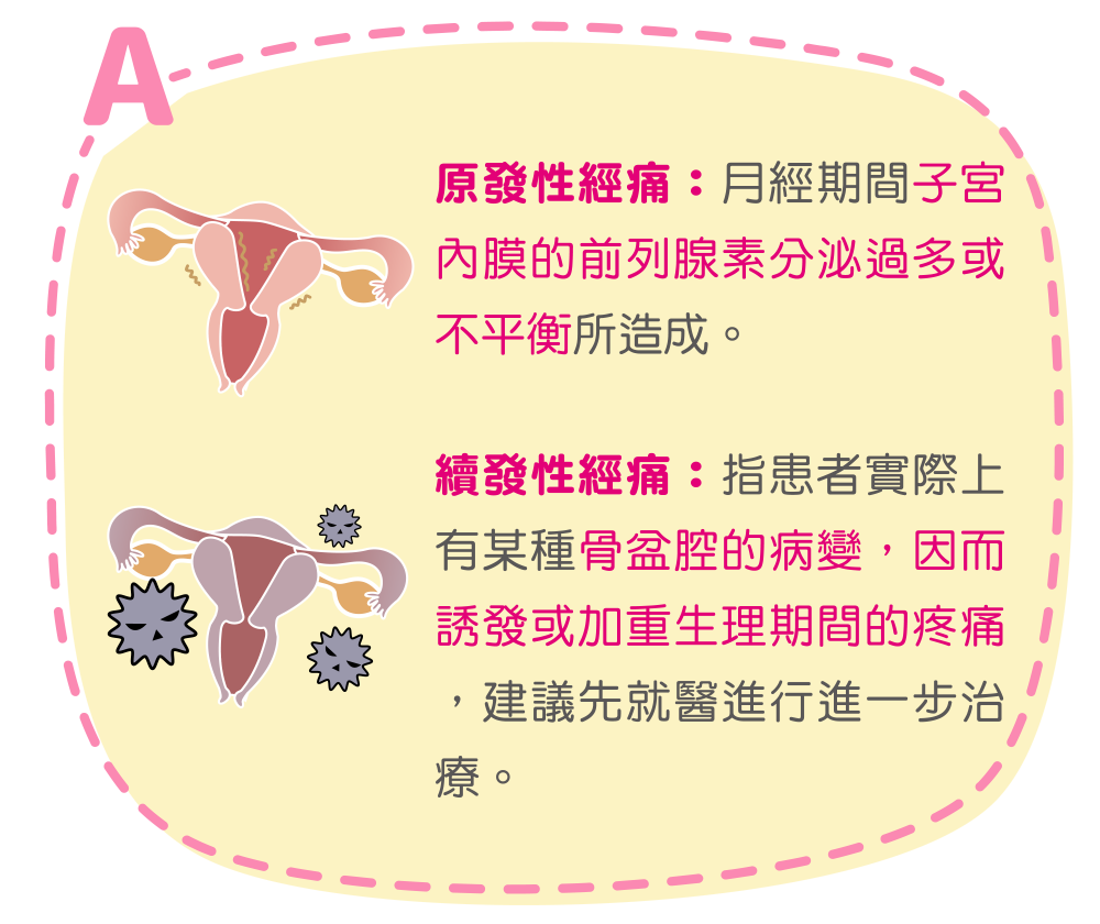 原發性經痛：月經期間子宮內膜的前列腺素分泌過多或不平衡所造成。 續發性經痛：指患者實際上有某種骨盆腔的病變，因而誘發或加重生理期間的疼痛，建議先就醫進行進一步治療。